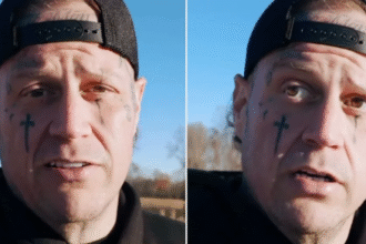 Jelly Roll’s Beardless Transformation Takes Fans by Surprise: See His New Look That’s Got Everyone Talking